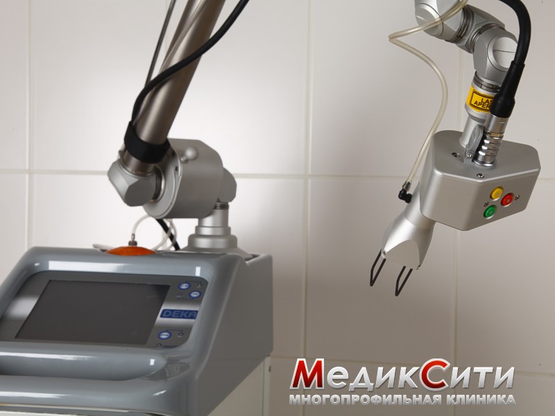 SmartXide DOT CO2