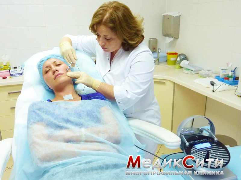 Сферофиллинг