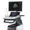 Ультразвуковой сканер HS60 (Samsung Medison)