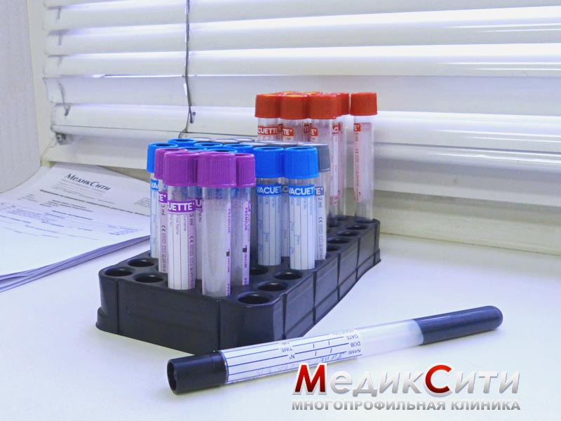 Лабораторная диагностика общие клинические анализы мочи крови