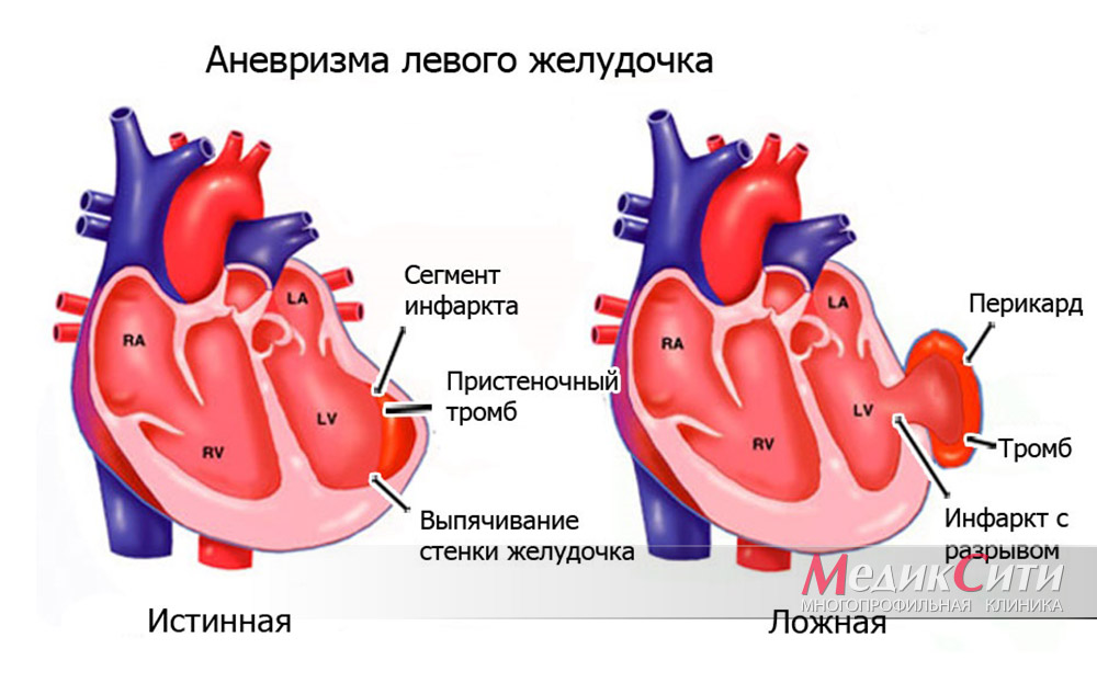 Как укрепить сердце: советы кардиолога и эффективные методы | kormstroytorg.ru