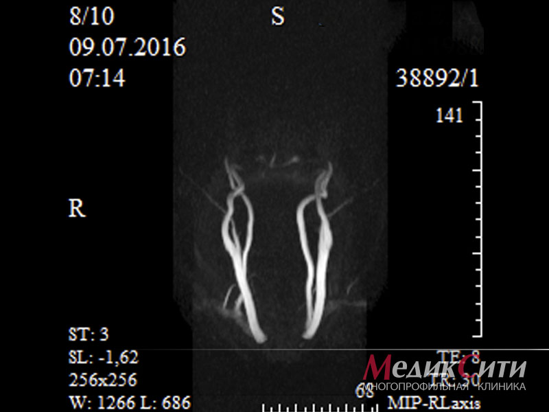 Мрт сосудов севастополь. K пространство мрт. Узи сосудов головного мозга нефтекамск отзывы. Мрт сосудов пенза. Впр сосудов головного мозга.